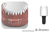 Zeramex XT Docklocs® ist ein vorgefertigtes Verbindungssystem zum Befestigen von herausnehmbarem Zahnersatz auf der Basis einer Schnappverbindung. Docklocs® Abutments sind in drei Grössen (2 mm / 3 mm / 4 mm) verfügbar und passen auf alle Implantatpla